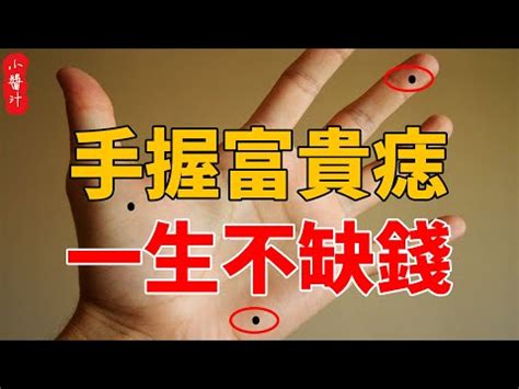 女右手掌突然長痣|女右手掌突現痣，命運將改變？